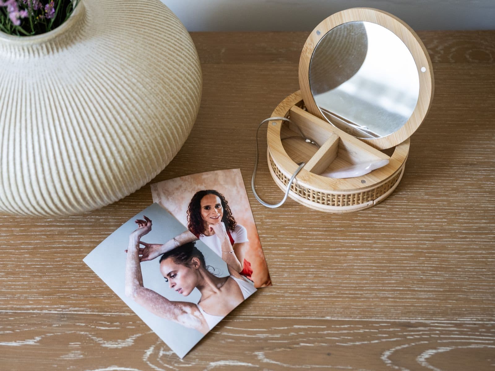 Two printed photos displayed on a table showing Natalie proudly displaying her vitiligo